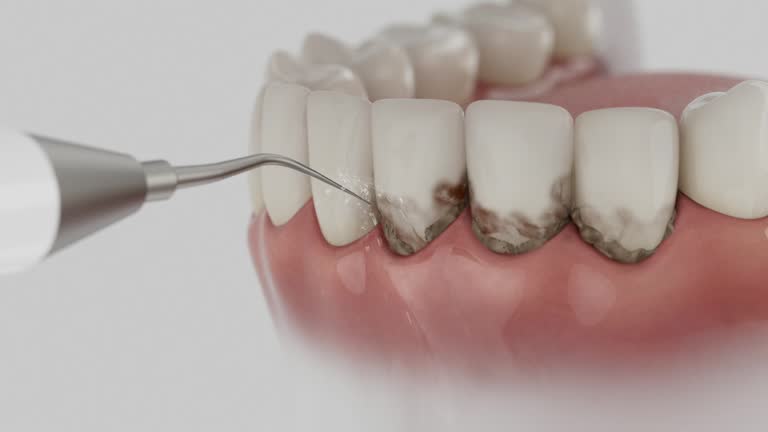 Reliable Dental contractor in White Marsh, MD by Smile Center Dentistry